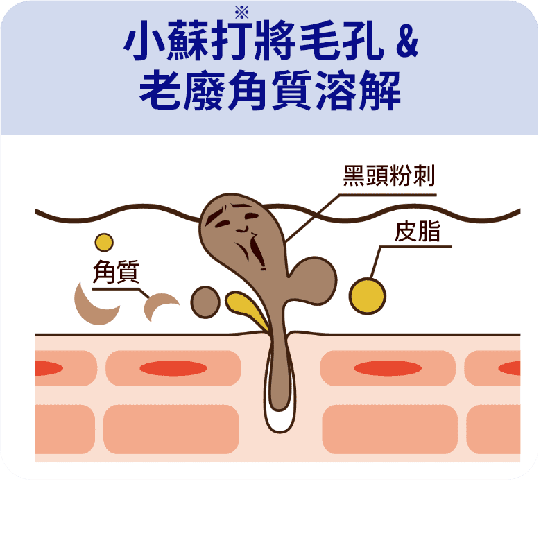 小蘇打將毛孔&老廢角質溶解