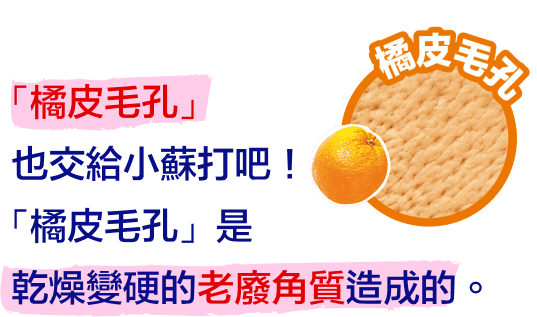 「橘皮毛孔」也交給小蘇打吧！「橘皮毛孔」是乾燥變硬的老廢角質造成的。
