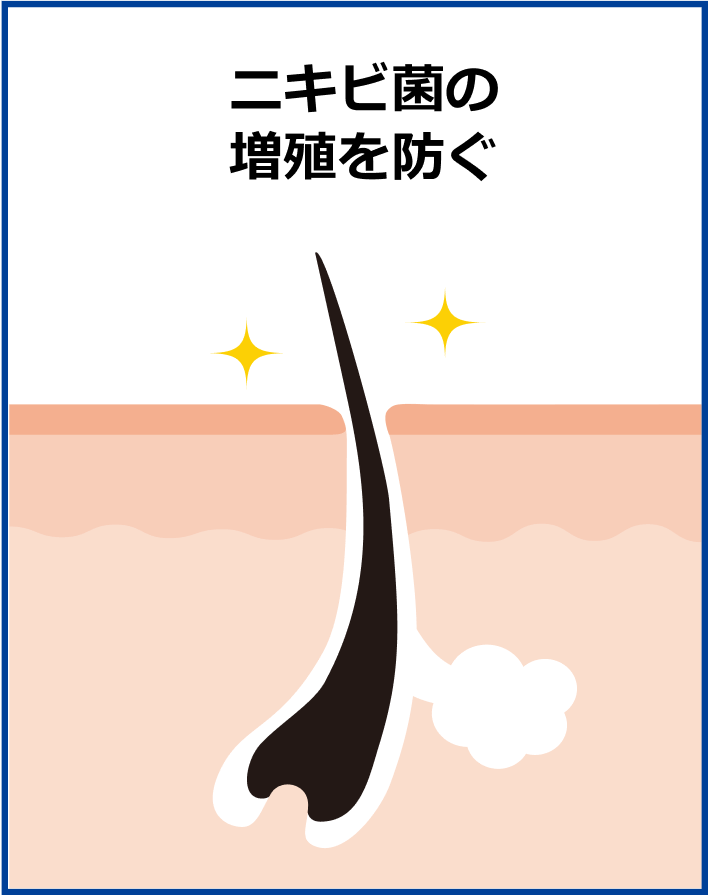 ニキビ菌の増殖を防ぐ