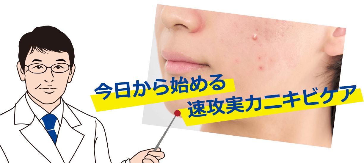 今日から始める速攻実力ニキビケア
