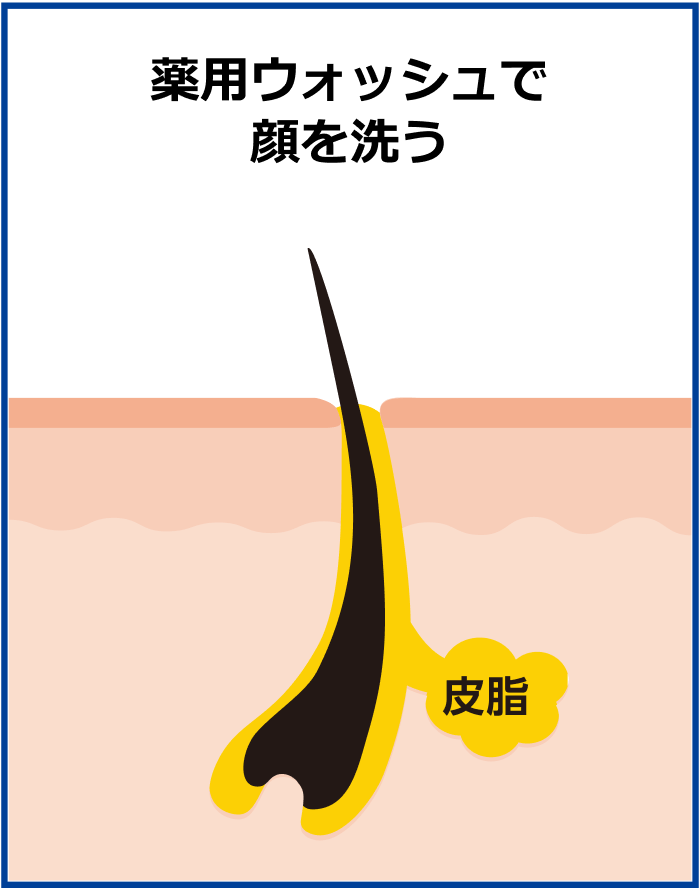薬用ウォッシュで顔を洗う 皮脂