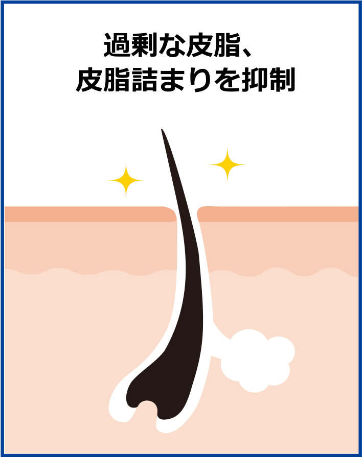 過剰な皮脂、皮脂詰まりを抑制