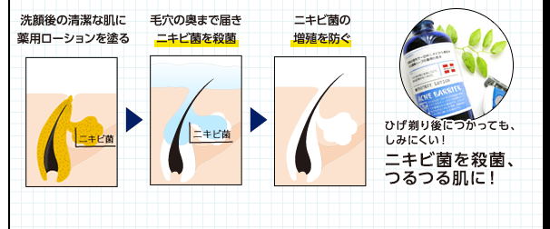 洗顔後の清潔な肌に薬用ローションを塗る　毛穴の奥まで届き、ニキビ菌を殺菌　ニキビ菌の増殖を防ぐ　ひげ剃り後につかっても、しみにくい！　ニキビ菌を殺菌、つるつる肌に！