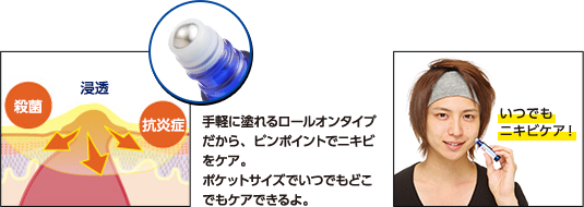 手軽に塗れるロールオンタイプだから、ピンポイントでニキビをケア。ポケットサイズでいつでもどこでもケアできるよ。　いつでもニキビケア