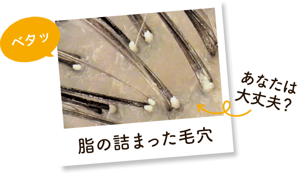 べたっ 脂の詰まった毛穴 あなたは大丈夫？