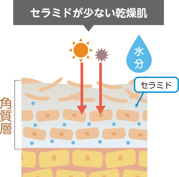 セラミドが少ない乾燥肌