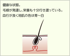 健康な状態。毛根が発達し、栄養も十分行き渡っている。血行が良く地肌の色は青～白