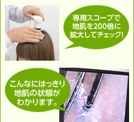 専用スコープで地肌を200倍に拡大してチェック！こんなにはっきり地肌の状態がわかります。