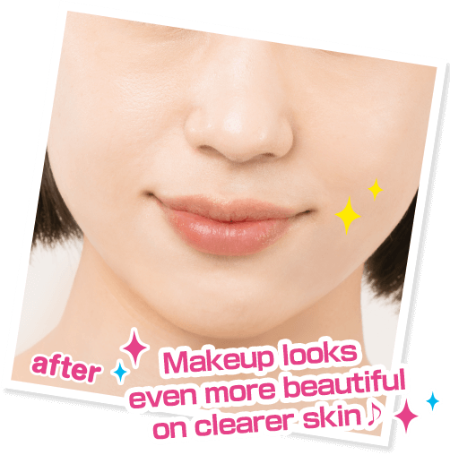 Makeup looks even more beautiful on clearer skin♪