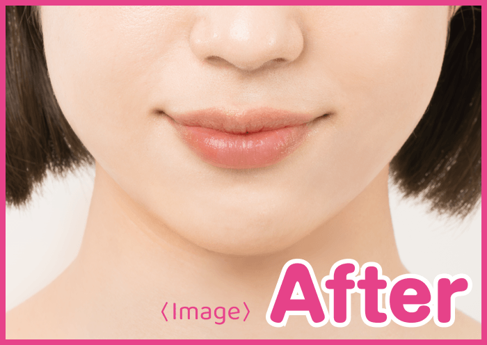 After