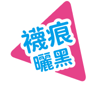 襪痕曬黑
